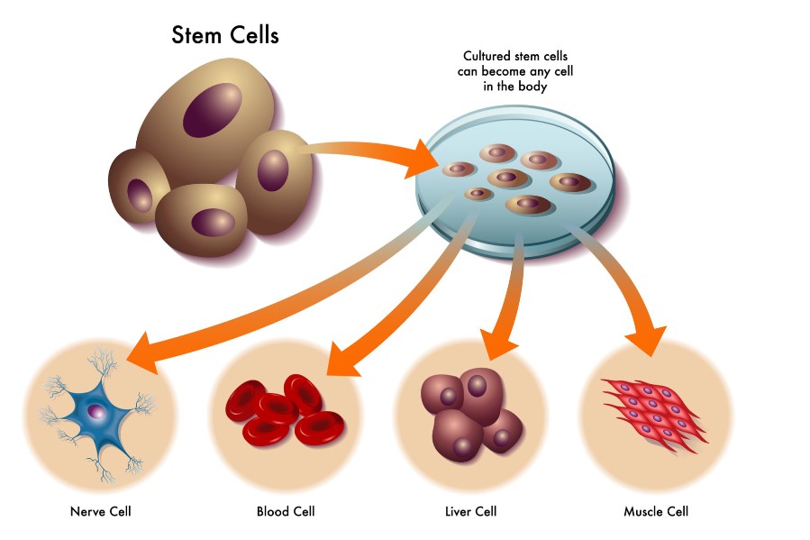 Trapianto Allogenico Di Cellule Staminali Cos