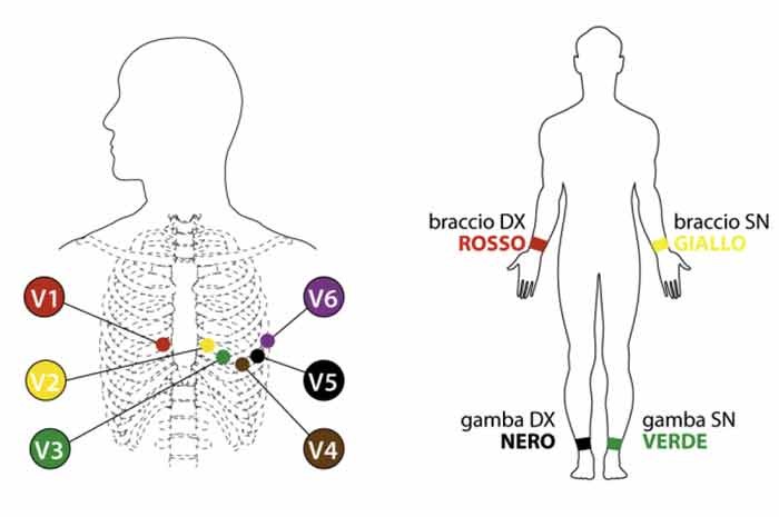 Elettrocardiogramma Pozycja Degli Elettrodi Dell Ecg