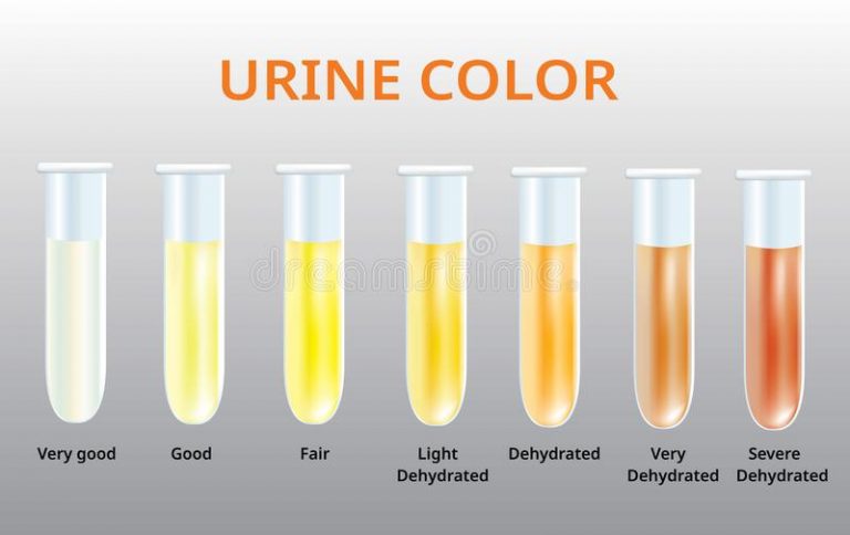 Alterazioni Di Colore Nelle Urine Quando Consultare Un Medico 