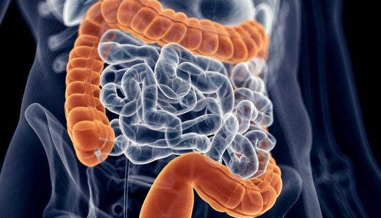 Malattie Infiammatorie Croniche Intestinali: Cosa Sono?