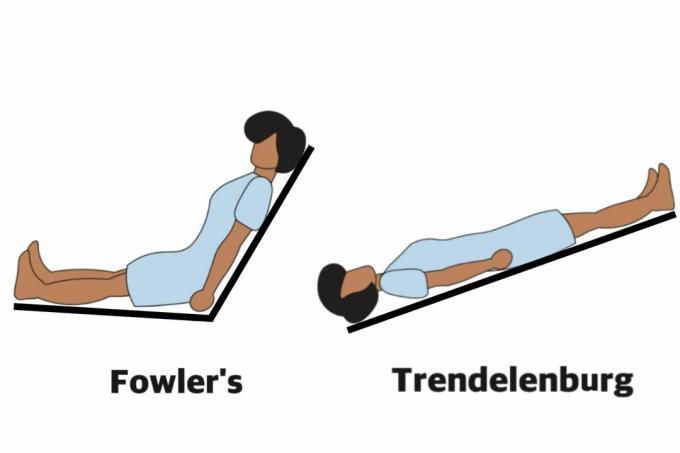 Stretcher The Fowler s Position Semi Fowler High Fowler Low Fowler